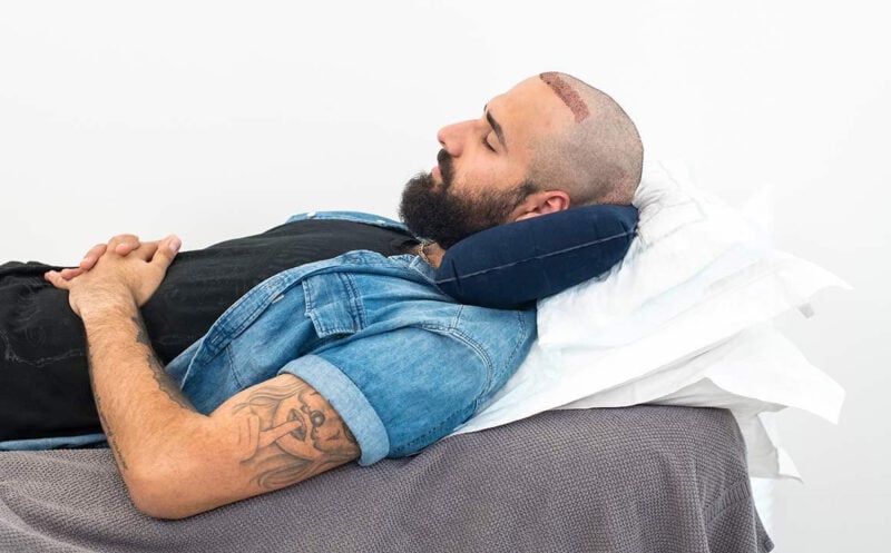 How to Sleep After a Hair Transplant